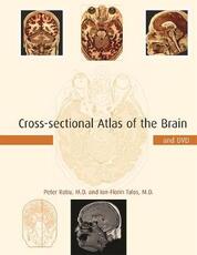 Libro in inglese Cross-sectional Atlas of the Brain and DVD Peter Ratiu Ion-Florin Talos