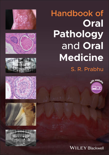 recent research topics in oral pathology