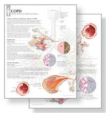 Libro in inglese Understanding COPD Study Set Replacement Pads: Patient Education Study Sets Scientific Publishing
