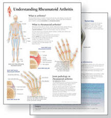 Libro in inglese Understanding Arthritis Study Set Replacement Pads: Patient Education Study Sets Scientific Publishing