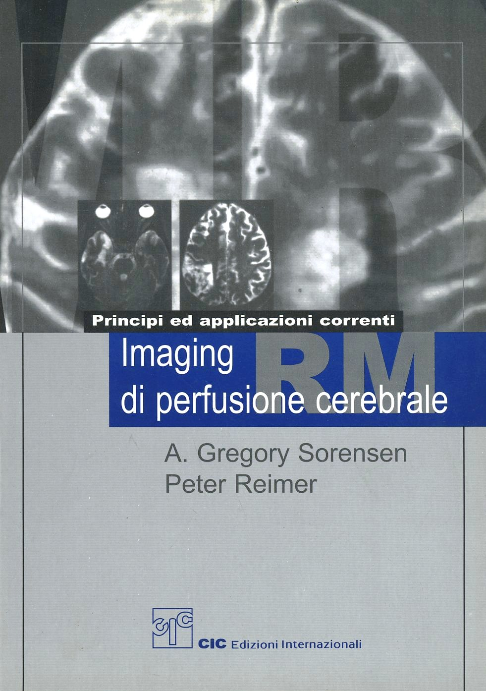 Principi ed applicazioni correnti. Imaging RM di perfusione cerebrale